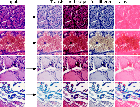 Normalization of HE-Stained Histological Images using Cycle Consistent Generative Adversarial Networks [Dataset]